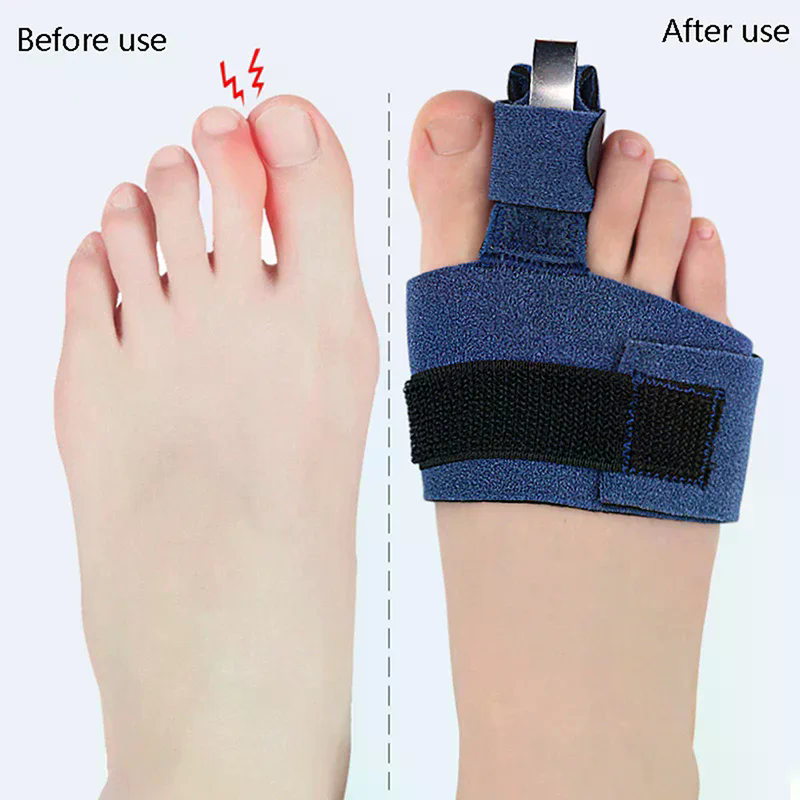 1Pcs Toe Corrector Toe Fractur - Ankle Brace Sock 리뷰 및 가격